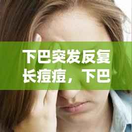 下巴突发反复长痘痘,下巴突发性长痘