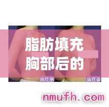 脂肪填充胸部后的潜在风险与后遗症解析
