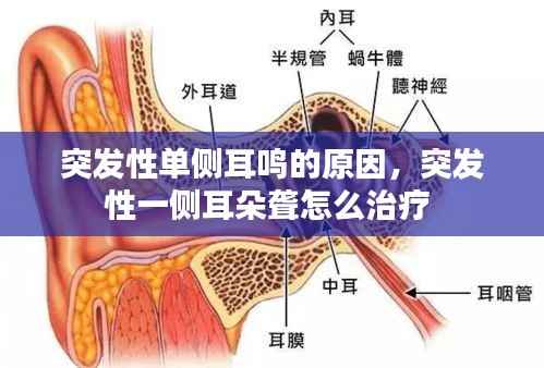 突发性单侧耳鸣的原因,突发性一侧耳朵聋怎么治疗